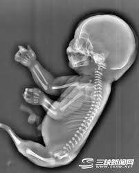 But what exactly is a mermaid? Real Life Baby Mermaid Has Been China Plus Culture Facebook