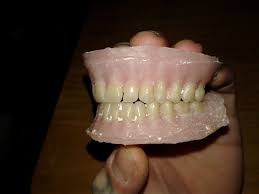 However, be sure to make small adjustments. Diy Dentures A Post Surgical Plan 12 Steps With Pictures Instructables