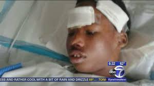 Police investigate how teen crashed through window in the Bronx after being  arrested