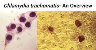 Image result for Chlamydia Trachomatis