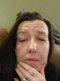 Hello I'm team January toothache is killing me