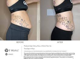 Pin On Tummy Wrapper It Works