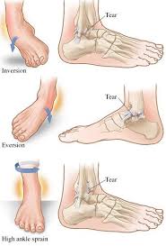 Pin On Anatomy Of Ankle