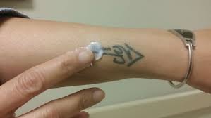 Allow your tattoo completely air dry in a clean environment. Tattoo Removal Cream Does It Work Authoritytattoo