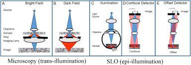 Structured illumination microscopy (sim) is based on the excitation of the sample with a known spatially structured pattern of light and relies on the generation of interference patterns known as moiré effect 7. Adaptive Optics Imaging Of The Human Retina Sciencedirect