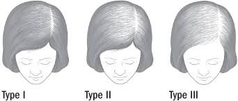 However, medical treatment may also be required for hair loss caused by certain conditions brought about by diabetes' complications. How To Prevent Hair Loss From Diabetes 7 Natural Tips