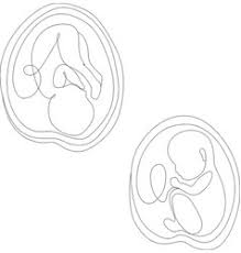 We did not find results for: Baby Womb Sketch Vector Images 83