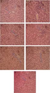 Image result for Hunteria umbellata