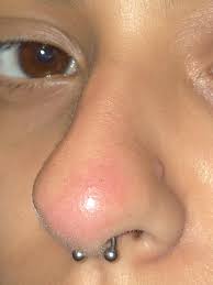 Got My Septum Piercing Done A Month Ago And Now The Tip My Nose Is Red But It Doesn T Hurt When I Touch It Is It Infected Piercing