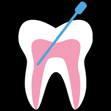 Zähne besitzen in ihrem inneren lebendes gewebe, die sogenannte pulpa, die wenn dieses empfindliche gewebe entzündet ist, hilft nur eine wurzelkanalbehandlung, umgangssprachlich oft auch kurz wurzelbehandlung genannt. Newsdetail