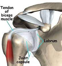 But you work on range of motion because sometimes the motion that you have in your shoulder may be abnormal after a labrum tear. Torn Shoulder Labrum Dr Ron Noy Orthopedic Surgeon Nyc