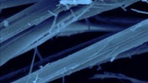 It usually occurs from prior exposure to asbestos, a type of mineral fiber used in the insulation industry. Deadline Approaches For Guernsey S Asbestos Related Cancer Compensation Scheme Itv News Channel
