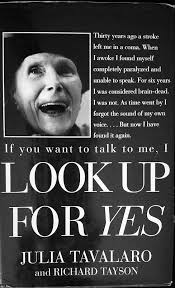 Julia, Living Locked-In::J O A N N A T U L L Y P H O T O G R A P H S