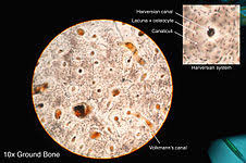 'compact or cortical bone is usually thick dense bone that forms the outer shell cross sections of the bone when studied under the microscope reveal quite a different picture. Osteon Wikipedia