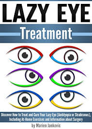 Learn the latest information on how to fix this issue. Lazy Eye Treatment Discover How To Treat And Cure Your Lazy Eye Amblyopia Or Strabismus Including At Home Exercises And Information About Surgery Kindle Edition By Jankovic Marien Professional Technical Kindle