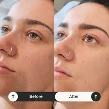 Sheer Elegance Skin Clinic