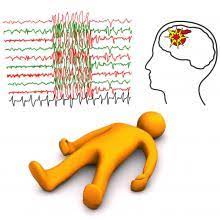 Idiopathic generralized epilepsies with myoclonus in infancy and childhood. Triggers Of Seizures Epilepsy Foundation