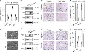 Competitive Endogenous Rna Is An Intrinsic Component Of Emt