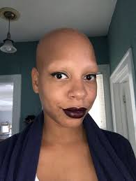 Thankfully that doesn't have to be the case, and there are certain ingredients and solutions that can help you restore your hair and take back the confidence you had in. 7 People Describe What It S Really Like To Have Alopecia Self