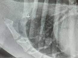 Symptoms of bone cancer in dogs limping or lameness (most often the first to manifest) localized swelling. Signs Of Osteosarcoma Lung Mets In Dogs Cats And Treatment Options
