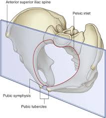 The pelvis articulates with the spine at the top and the femoral bones at the bottom. Pelvis And Perineum Clinical Gate