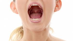 Iar acum, abia mai poate să vorbească şi să mănânce. Cancer Gat Primele Simptome 2 Dureri In Gat