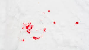 Faites tremper le tissu dans une bassine d'eau froide pendant quelques minutes. Comment Nettoyer Une Tache De Sang Cote Maison