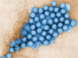 In fact, there's no such thing as stomach flu. New Norovirus Strain Rips Through The U S Shots Health News Npr
