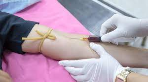 Entzundungswert Im Blut Das Sagen Die Ergebnisse Aus Focus De