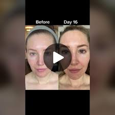 Replying to @toofunnytodie420 What do you think, before or after?! #se...