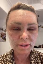 RHOC's Tamra Judge Looks Unrecognizable After Cosmetic Procedure