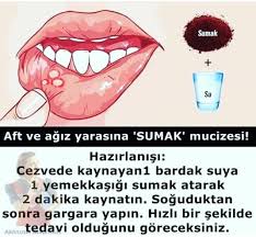 Aft Ve Agiz Yarasi Spor Saglik Saglikliyasam Saglikliyasam Fit Fitness Kardiyo Kiloverme Zayiflamak Prat Health Detox Health Fitness Healthy Beauty