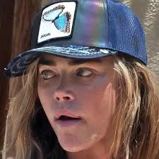 Denise Richards seen with black eye days after estranged husband Aaron  Phypers called cops