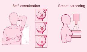 Breast Lumps – Types, Causes And Reasons For Concern | Health Plus