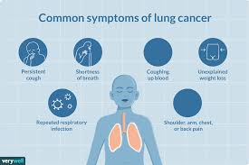 Geminis are known to be unstable and with cancer's gentle and sensitive soul, this would not really work well. Lung Cancer Signs Symptoms And Complications