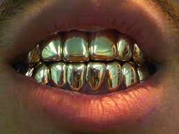 Heimdall Gold Teeth Grillz Gold Teeth Grillz