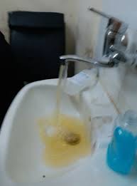 مياه بلون الصدأ شكوك حول تلوث مائي في مستشفى الشفاء بمدينة غزة