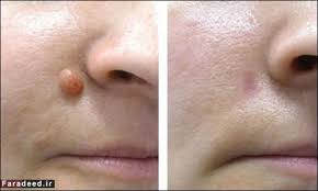 تصویر مرتبط