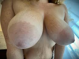 My big hanging torpedo tits.