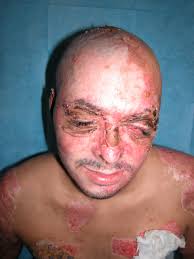 From Hospital To Hollywood A Soldier S Story Article The United States Army Blood, body, corpse, dead, headshot, zombie icon. from hospital to hollywood a soldier s