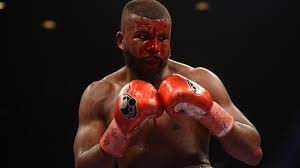 Badou johannes gabriel jack (born 31 october 1983) is a swedish professional boxer. Trotz Horror Cut Boxender Wohltater Badou Jack Kampft Bis Zum Ende