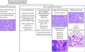 Plasma cells are a type of white blood cell that makes antibodies. Histological Classification Of Lung Cancer Lung Cancer Can Be Download Scientific Diagram
