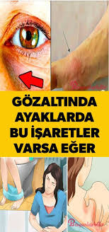 Yuksek Kan Sekeri Belirtileri Nelerdir Kan Sekeri Saglik Saglikli