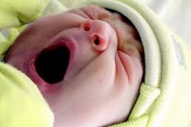 Jerawat ini menyebabkan kemunculan bercak merah atau bintik putih kecil pada kulit di bintik merah atau ruam pada kulit bayi yang satu ini muncul akibat iritasi atau infeksi dari bakteri di folikel rambut. Ibu Kenali 5 Masalah Mulut Yang Mungkin Akan Dialami Bayi Bukareview