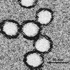 O femeie de 83 de ani! Virusul West Nile Wikipedia