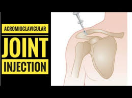 Image result for Joint Injection