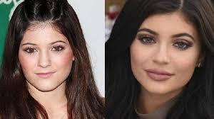 Subreddit dedicated to kendall jenner. Perubahan Wajah Kylie Jenner Ini Sempat Menghebohkan Lebih Cantik Dulu Apa Sekarang Tribun Solo