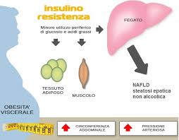 L'incapacità delle cellule di legare l'ormone e quindi di rispondere al suo segnale fa si che il glucosio non possa essere assorbito e quindi utilizzato dalle cellule. Insulina Resistenza