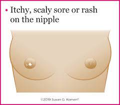 To help you become a more informed patient, here are 10 facts that your doctor might not tell you about breast cancer treatment: Warning Signs Of Breast Cancer Do You Know What To Watch For