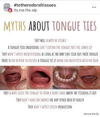 Pin By Adriana Dile Bloise On Tot S Tongue Tie Dental Hygiene Breastfeeding